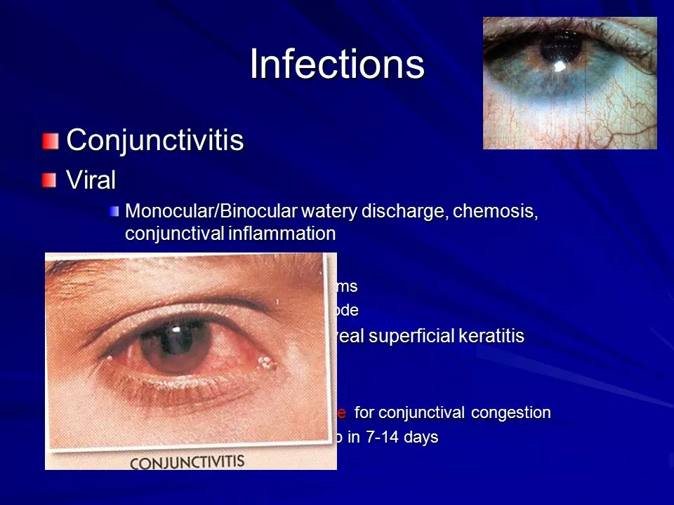 The role of besifloxacin in the management of post-operative ocular infections