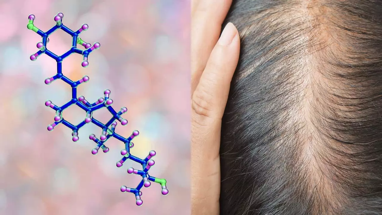 The Connection Between Vitamin D Deficiency and Hair Loss