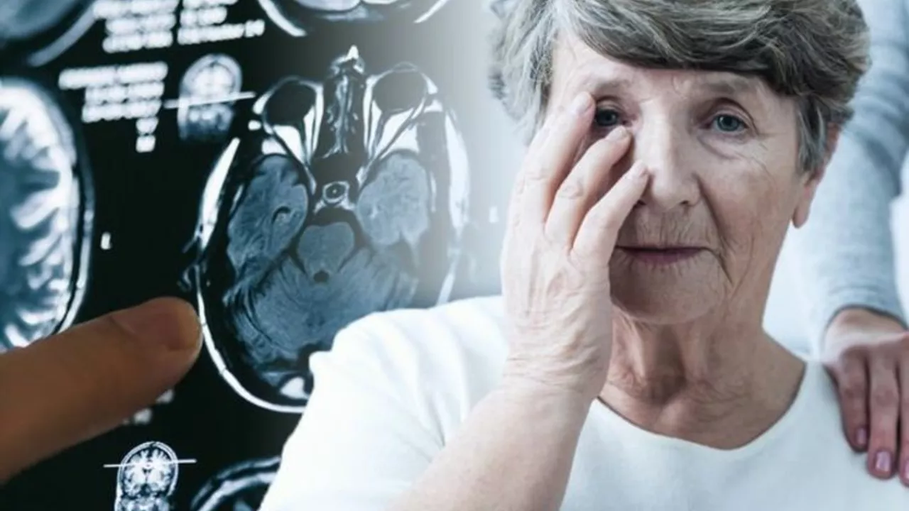 How to Manage Sundowning in Alzheimer-type Dementia Patients